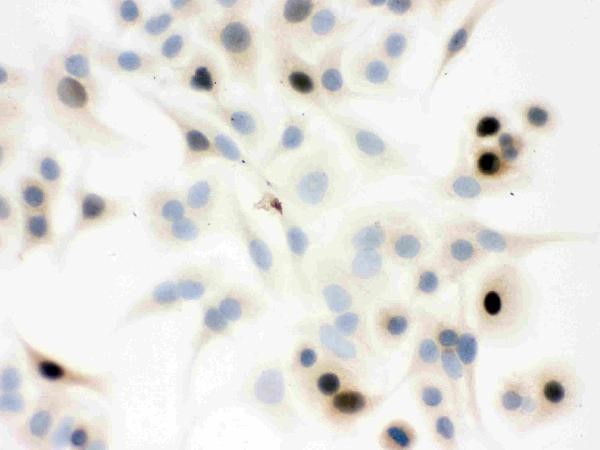 Immunocytochemistry analysis of Cyclin A